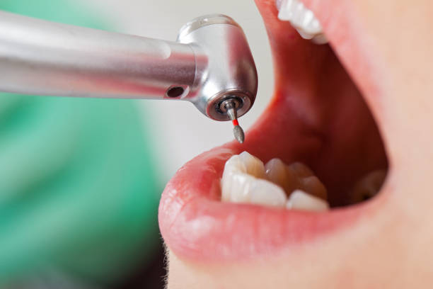 Best Emergency Denture Repair in Cheney, KS